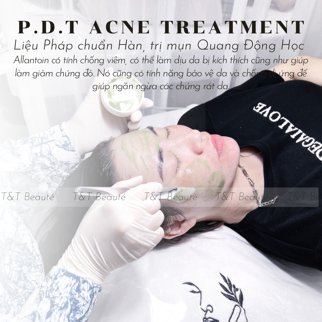 PDT Acne Therapy (Liệu pháp Quang Động học trị mụn)