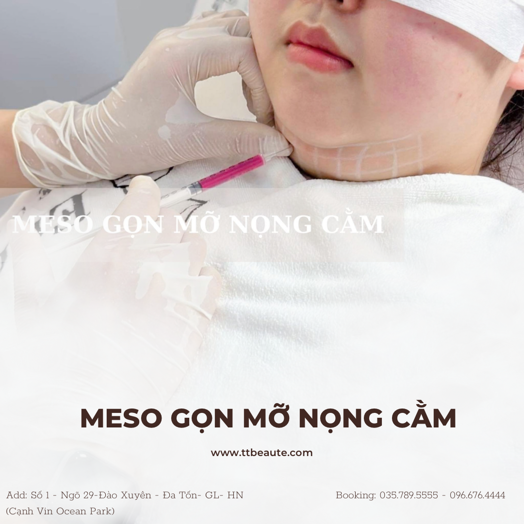 Meso Giảm mỡ  Bụng